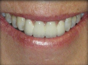 Close-up of a smile showing white, well-aligned teeth.