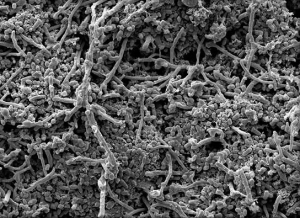 Microscopic view of fungal hyphae and spores.