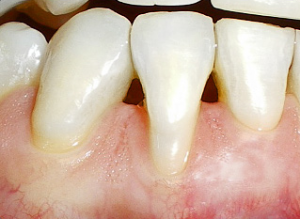 Close-up of healthy human teeth and gums.