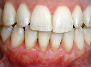 Close-up of healthy human teeth and gums.