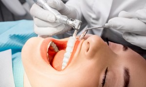 Dentist performing a dental cleaning on a patient.