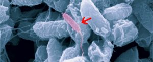 Microscopic view of bacteria with a red arrow pointing to a specific bacterium.