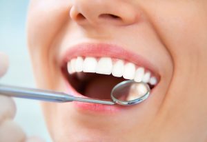 Close-up of a dental checkup with a mirror inside a smiling mouth.