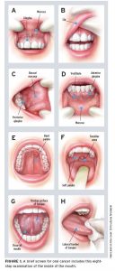 Illustrations of mouth anatomy showing palate, uvula, and tonsils.