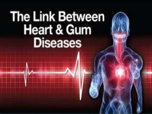 Illustration linking heart health and gum disease with human body and heartbeat graphic.