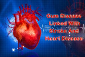 Illustration linking gum disease to stroke and heart disease.