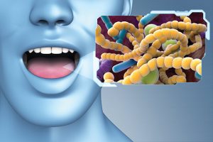 Close-up of mouth with enlarged bacteria illustration.