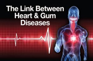 Visual linking heart and gum diseases with a heart rate graph.